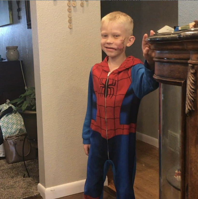 6 yaşında süper kahraman oldu! Biri ölecekse o ben olmalıydım - Resim: 4