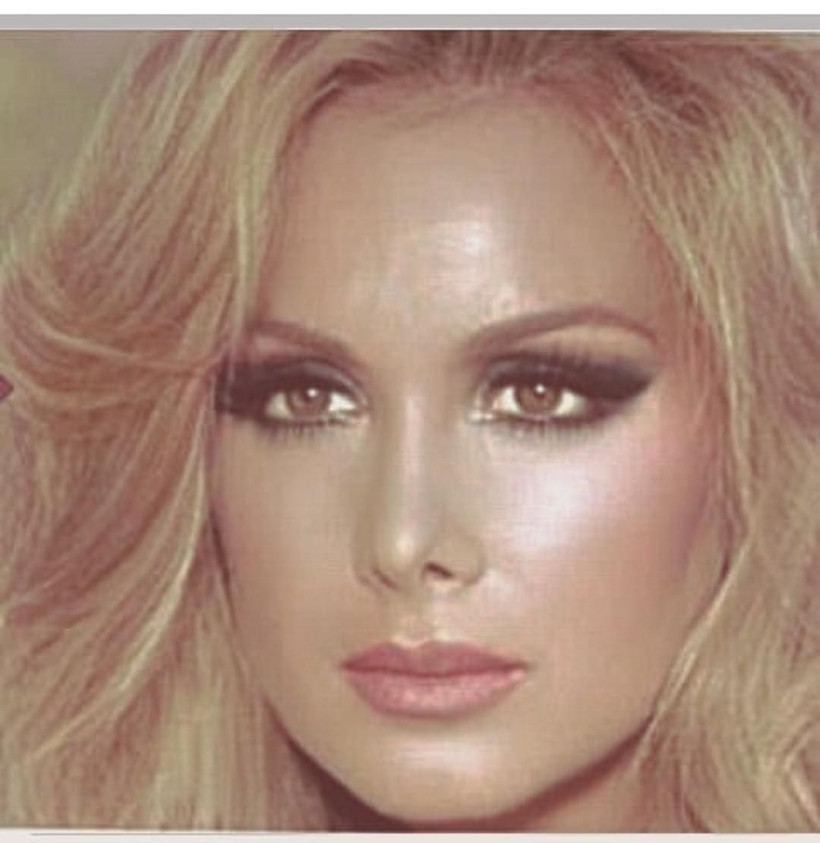 Yeşilçam'ın usta oyuncu Filiz Akın, son haliyle takipçilerini üzdü! - Resim: 2