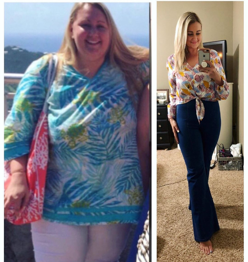 70 yaşında gibi hissediyordu! Onu bir de şimdi görün Son hali fena - Resim: 3