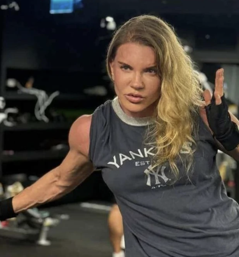 Biricik Suden'den estetik açıklaması! Filtresiz paylaştı - Resim: 3