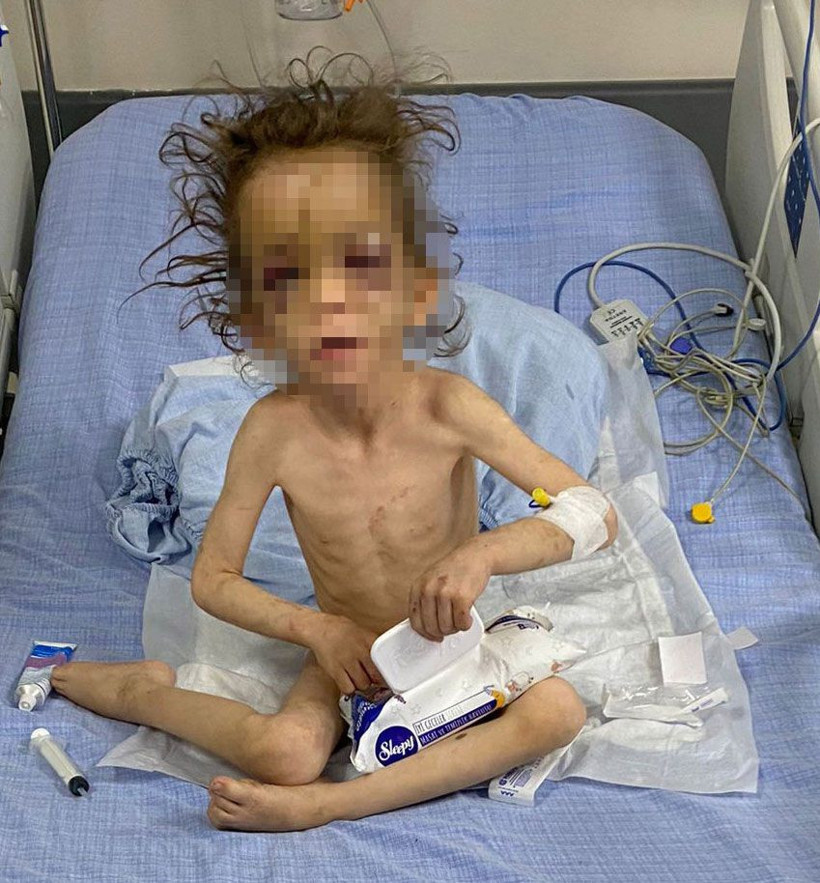 Gaziantep'te cani anne 5 yaşındaki çocuğunu günlerce aç bırakıp işkence etti - Resim: 1