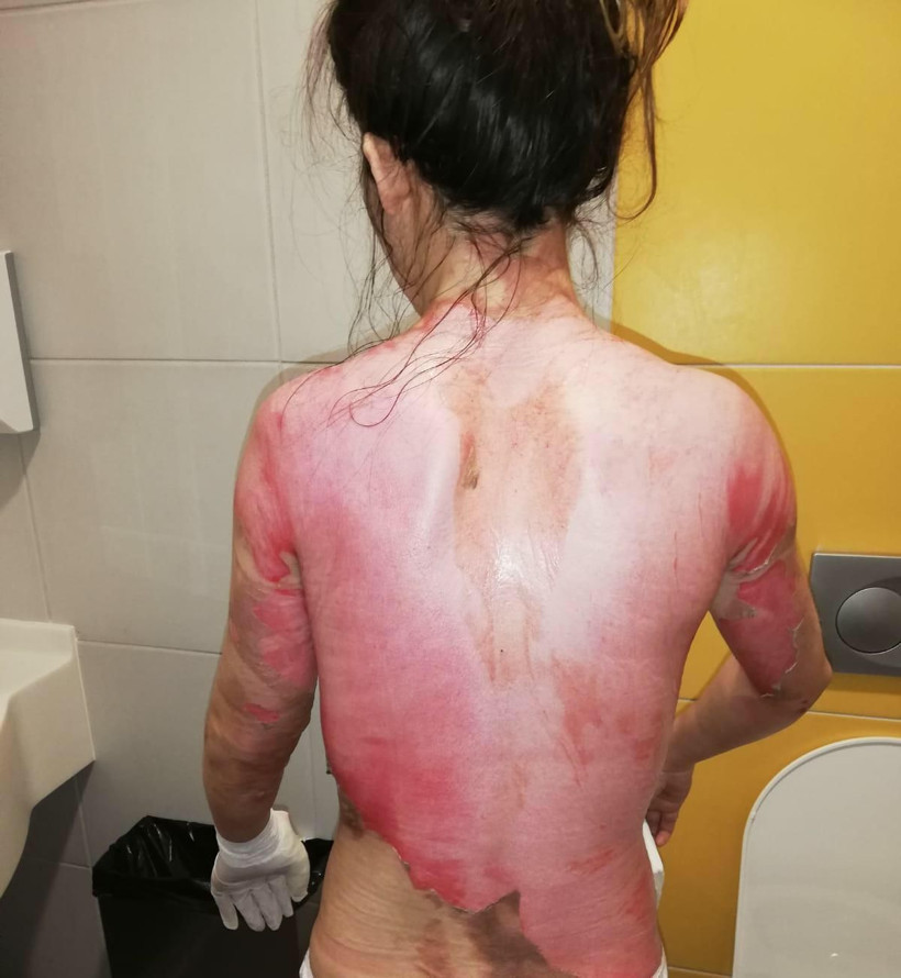 Konya'da 'koca' vahşeti! 1,5 yaşındaki kızıyla eşine kaynar su döktü serbest kaldı - Resim: 4