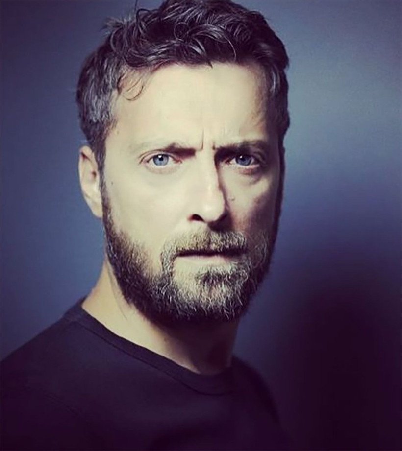 Payitaht Abdülhamit'in ünlü oyuncusuna taksiciden 'kısa mesafe' dayağı! Burnu kırıldı, bileği ve parmakları çatladı - Resim: 4