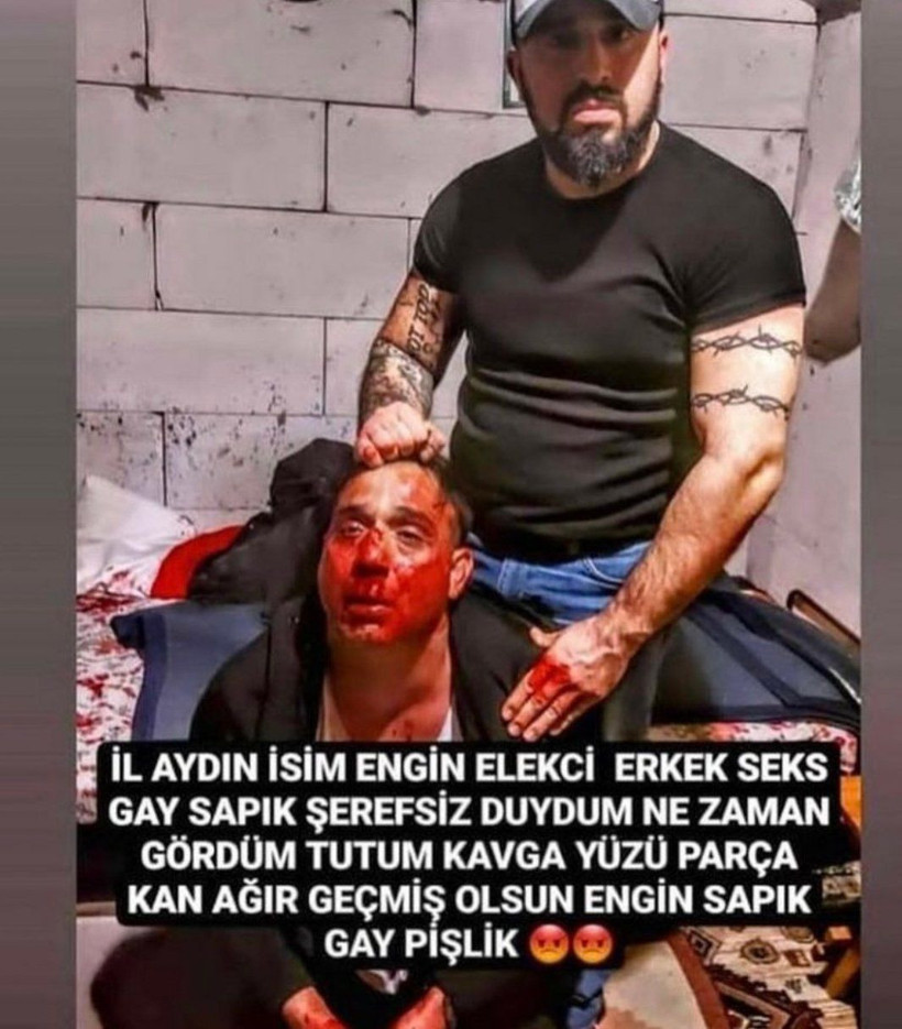 'Delikanlı' lakaplı Fırat Kaya işitme engelli gence işkence etti: Çıplak fotoğraflarımı gösterip darp ettiler - Resim: 3