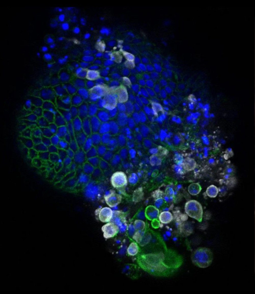 Koronavirüsün detaylı ve yüksek çözünürlüklü görüntüleri ilk kez yayımlandı - Resim: 2