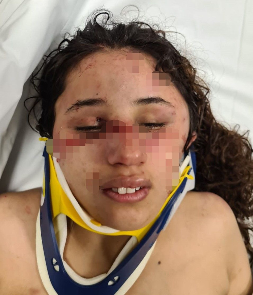 Adana'da 7 aylık hamile eşe günlerce işkence! Beyin kanaması geçiren kadın yoğun bakımda - Resim: 4