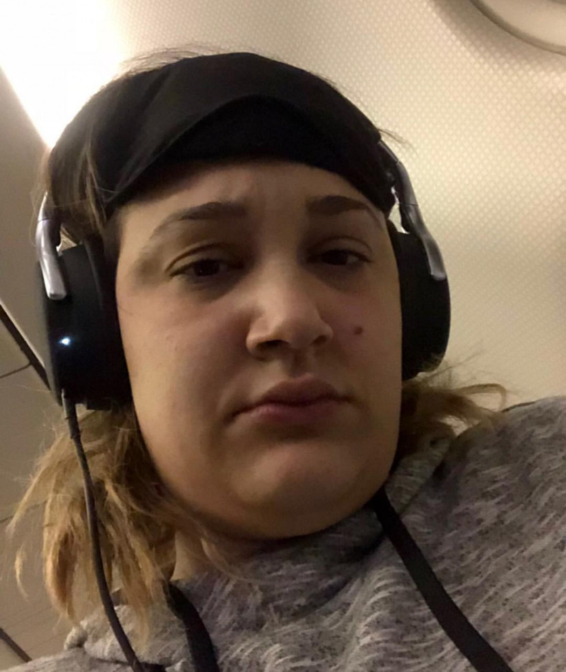 Gupse Özay'ın film için aldığı kilolar başına bela oldu - Resim: 1